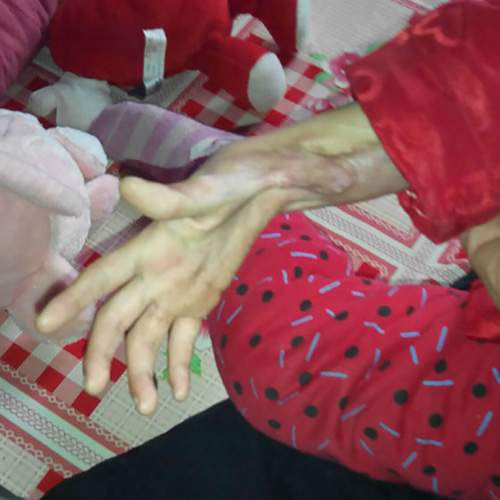 ���ֲƤ�������F(xi��n)�˷ǳ���(y��n)�صİ̺������F(xi��n)��